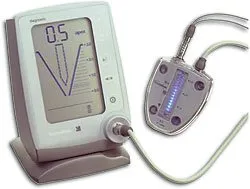 Apex locator